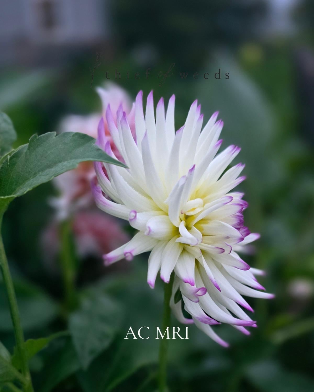 AC MRI